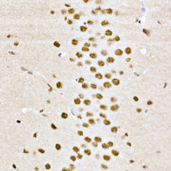 Anti-Phospho-CREB1 (Ser133) Rabbit pAb