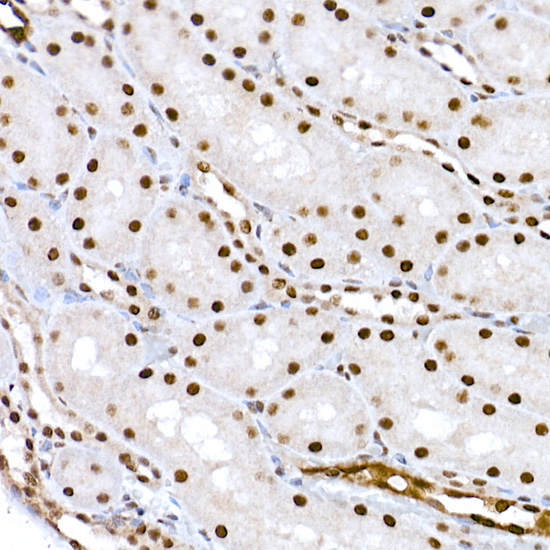 Anti-Phospho-CREB1 (Ser133) Rabbit pAb