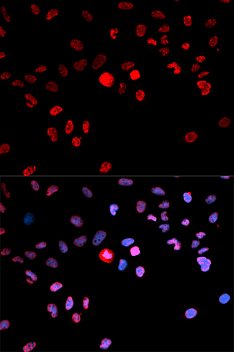 Anti-Phospho-CREB1 (Ser133) Rabbit pAb