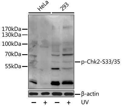 Anti-Phospho-Chk2 (Ser33/Ser35) Rabbit pAb