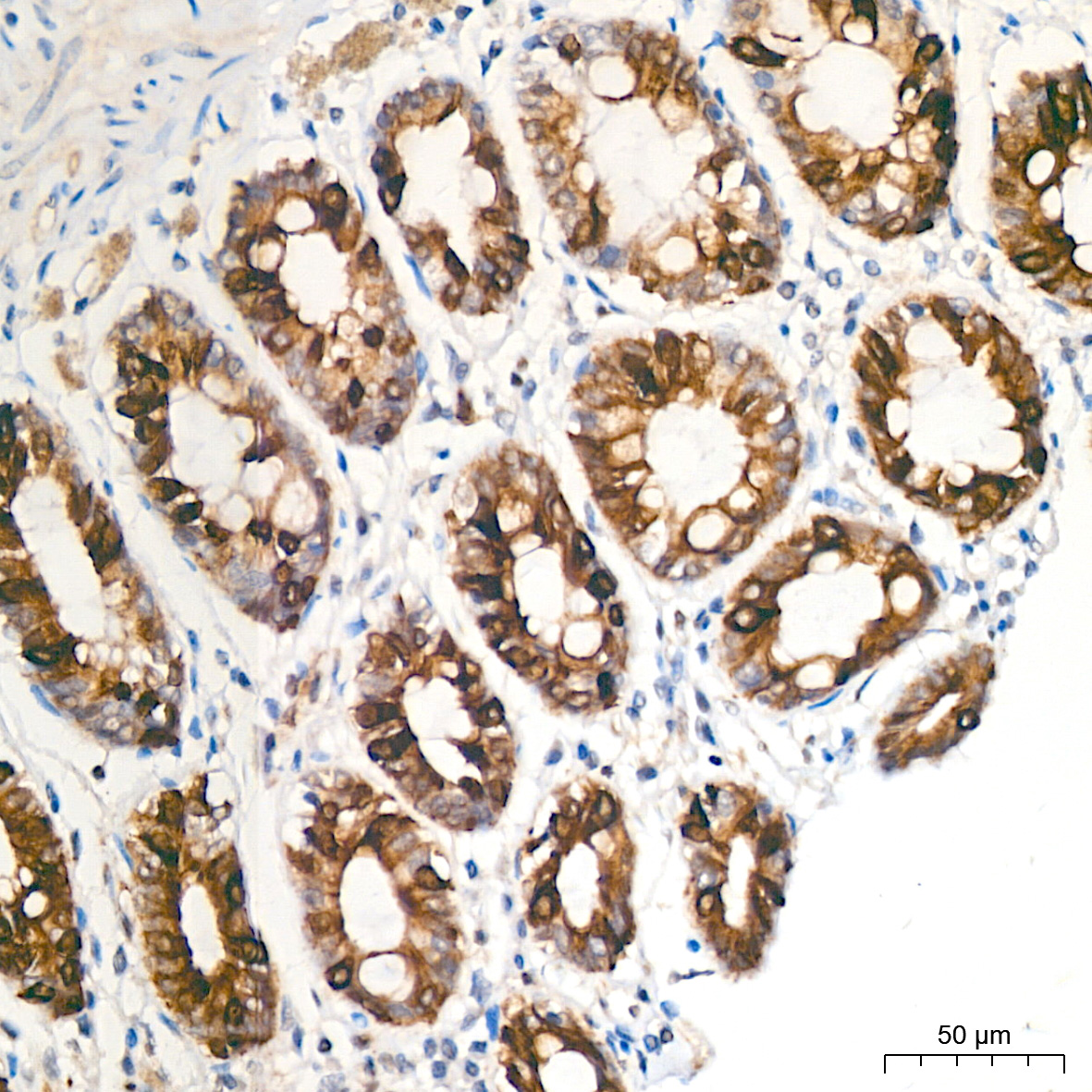Anti-Phospho-GSK3 beta (Ser9) Rabbit pAb