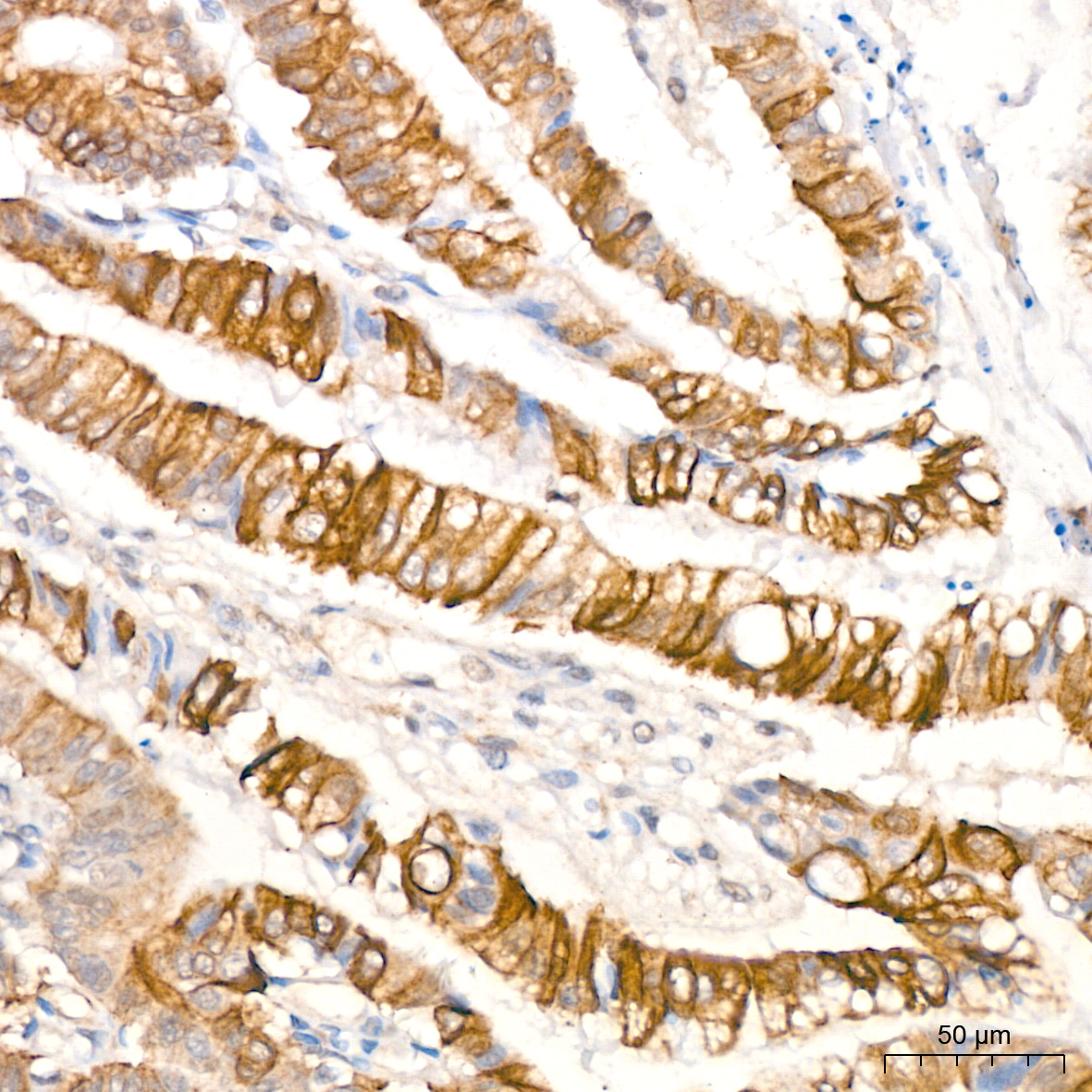 Anti-Phospho-GSK3 beta (Ser9) Rabbit pAb