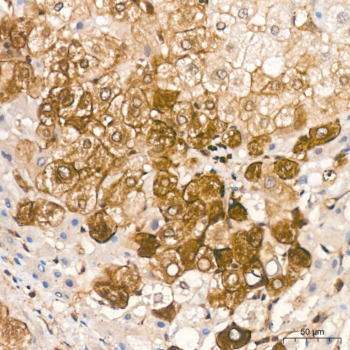 Anti-Phospho-GSK3 beta (Ser9) Rabbit pAb