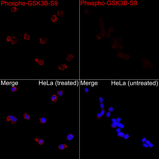 Anti-Phospho-GSK3 beta (Ser9) Rabbit pAb