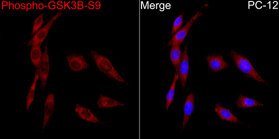 Anti-Phospho-GSK3 beta (Ser9) Rabbit pAb