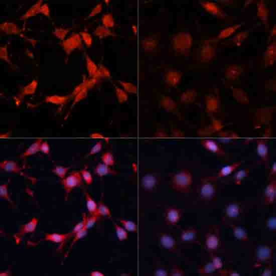 Anti-Phospho-S6K1 (Thr389) Rabbit pAb