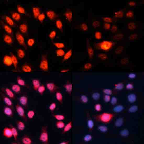 Anti-Phospho-S6K1 (Thr389) Rabbit pAb