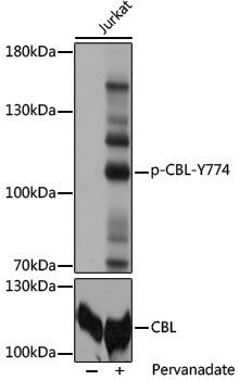 Anti-Phospho-CBL (Tyr774) Rabbit pAb