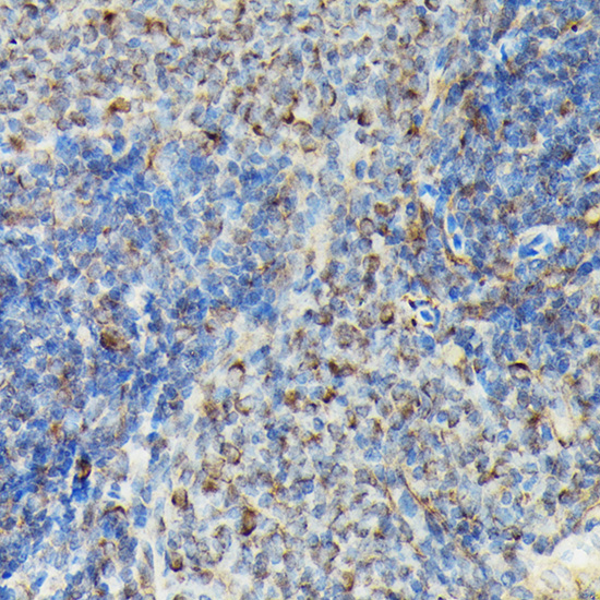 Anti-Phospho-VASP (Ser239) Rabbit pAb