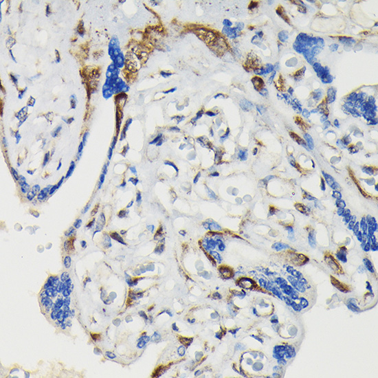 Anti-Phospho-VASP (Ser239) Rabbit pAb