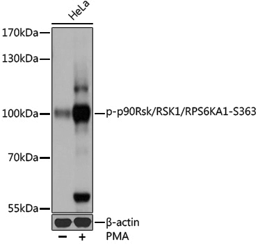 Anti-Phospho-RSK1 p90 (Ser363) Rabbit pAb