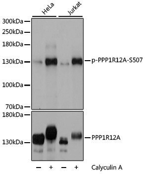 Anti-Phospho-MYPT1 (Ser507) Rabbit pAb