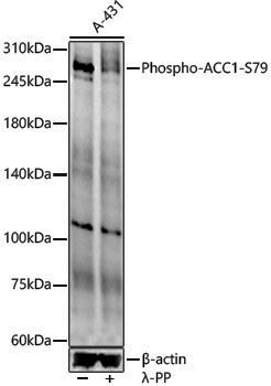 Anti-Phospho-Acetyl Coenzyme A Carboxylase (Ser79) Rabbit pAb