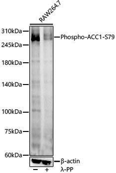 Anti-Phospho-Acetyl Coenzyme A Carboxylase (Ser79) Rabbit pAb