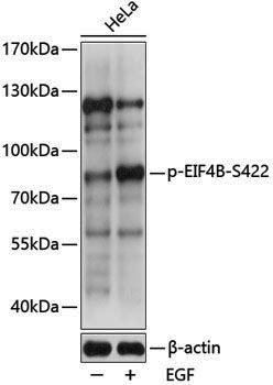 Anti-Phospho-eIF4B (Ser422) Rabbit pAb