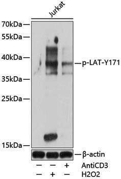 Anti-Phospho-LAT (Tyr171) Rabbit pAb