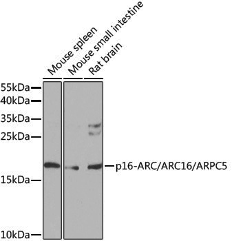 Anti-p16 ARC Rabbit pAb