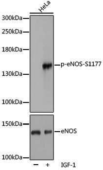 Anti-Phospho-eNOS (Ser1177) Rabbit pAb