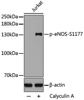 Anti-Phospho-eNOS (Ser1177) Rabbit pAb