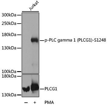 Anti-Phospho-PLCG1 (Ser1248) Rabbit pAb