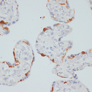 Anti-Phospho-PLCG1 (Ser1248) Rabbit pAb