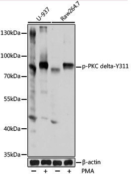 Anti-Phospho-PKC delta (Tyr311) Rabbit pAb
