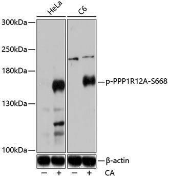 Anti-Phospho-MYPT1 (Ser668) Rabbit pAb
