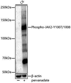 Anti-Phospho-JAK2 (Tyr1007/Tyr1008) Rabbit pAb