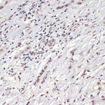 Anti-Phospho-JAK2 (Tyr1007/Tyr1008) Rabbit pAb