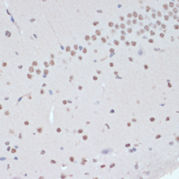 Anti-Phospho-JAK2 (Tyr1007/Tyr1008) Rabbit pAb