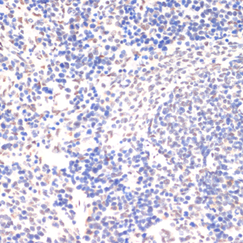 Anti-Phospho-JAK2 (Tyr1007/Tyr1008) Rabbit pAb
