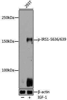 Anti-Phospho-IRS1 (Ser636/Ser639) Rabbit pAb