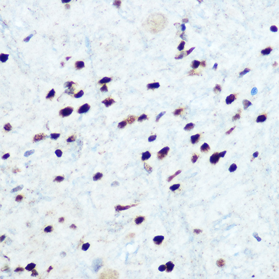 Anti-Phospho-IKB alpha (Ser32) Rabbit pAb