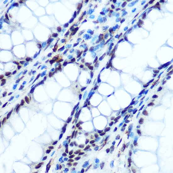 Anti-Phospho-IKB alpha (Ser32) Rabbit pAb