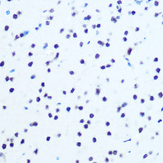 Anti-Phospho-IKB alpha (Ser32) Rabbit pAb