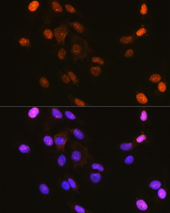 Anti-Phospho-IKB alpha (Ser32) Rabbit pAb