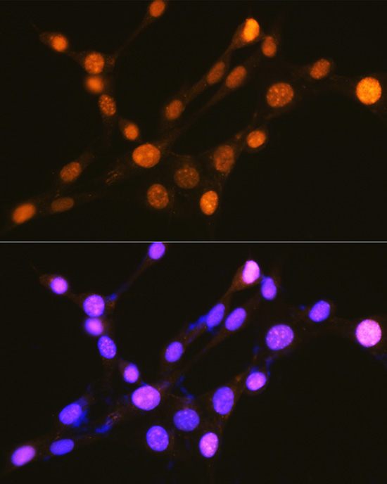 Anti-Phospho-IKB alpha (Ser32) Rabbit pAb