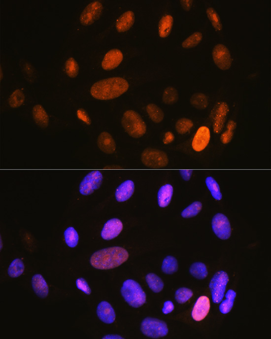Anti-Phospho-IKB alpha (Ser32) Rabbit pAb