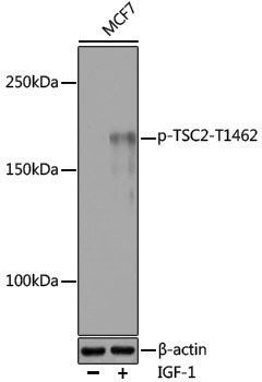 Anti-Phospho-Tuberin (Thr1462) Rabbit pAb