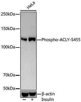 Anti-Phospho-ATP Citrate lyase (Ser455) Rabbit pAb