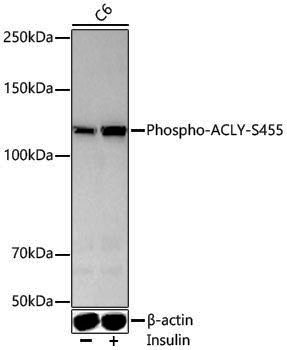 Anti-Phospho-ATP Citrate lyase (Ser455) Rabbit pAb