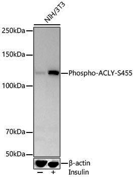 Anti-Phospho-ATP Citrate lyase (Ser455) Rabbit pAb