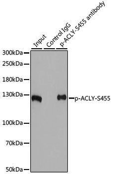 Anti-Phospho-ATP Citrate lyase (Ser455) Rabbit pAb