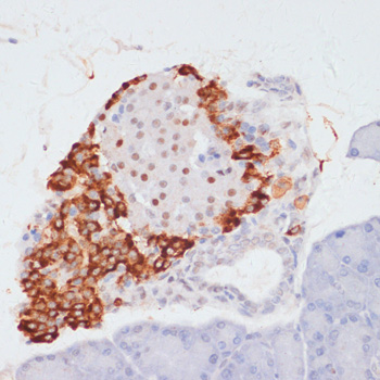 Anti-Phospho-ATP Citrate lyase (Ser455) Rabbit pAb