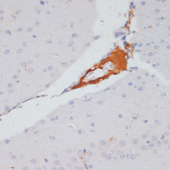 Anti-Phospho-ATP Citrate lyase (Ser455) Rabbit pAb