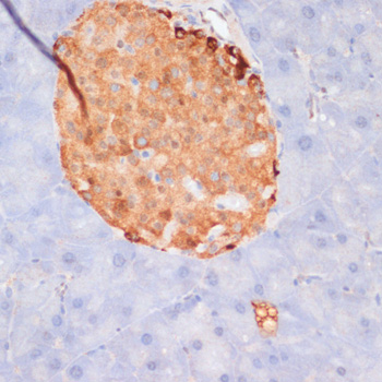 Anti-Phospho-ATP Citrate lyase (Ser455) Rabbit pAb