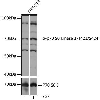 Anti-S6KPhospho-S6K1 (T421/S424)1 Rabbit pAb