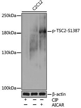 Anti-Phospho-Tuberin (Ser1387) Rabbit pAb
