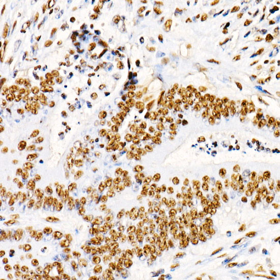 Anti-Phospho-PTEN (Ser380/Thr382/Thr383) Rabbit pAb