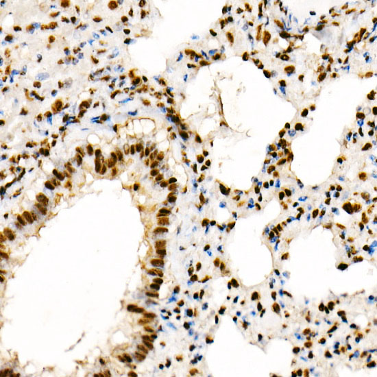 Anti-Phospho-PTEN (Ser380/Thr382/Thr383) Rabbit pAb